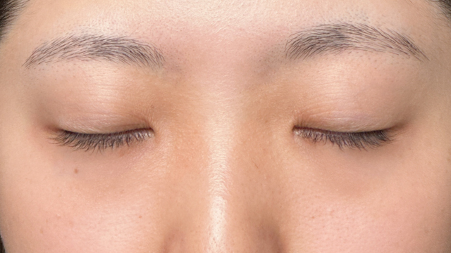 Postoperative Condition Part 1