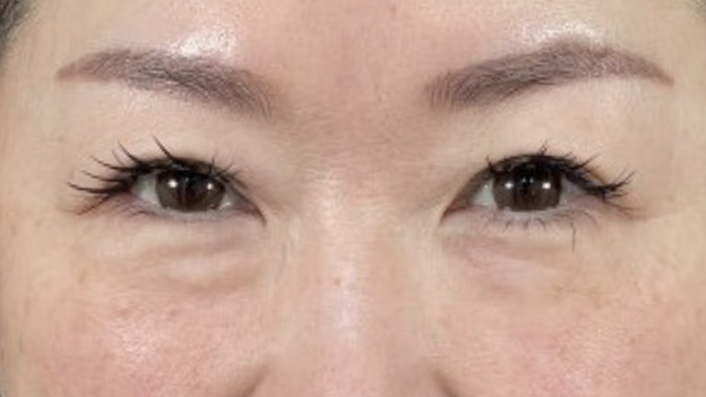 Postoperative Condition Part 1