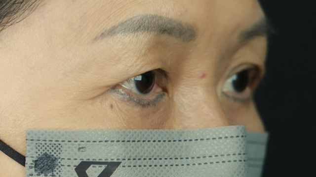 Postoperative Condition Part 1