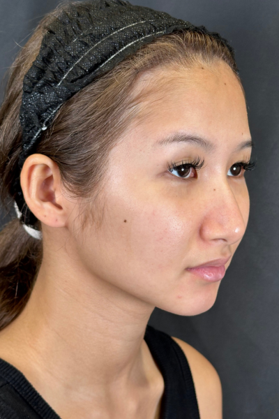 Postoperative Condition Part 1