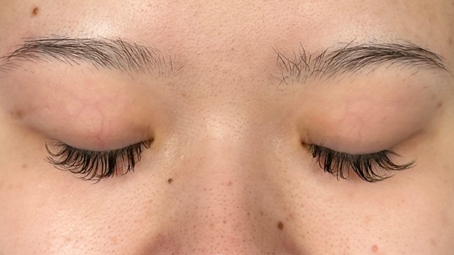 Postoperative Condition Part 1