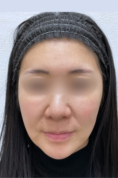 手術前の状態 その1