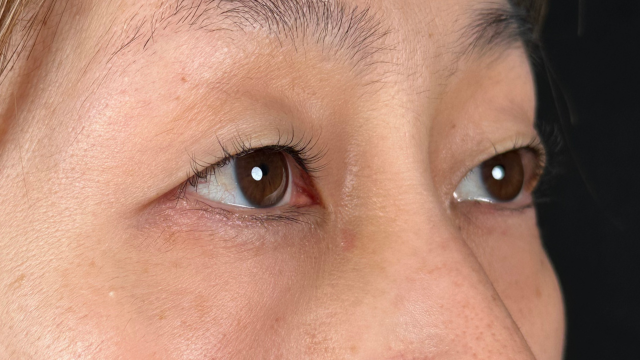 Postoperative Condition Part 1