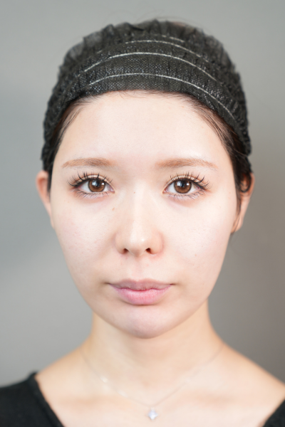 Postoperative Condition Part 1