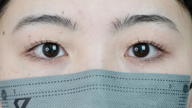 Postoperative Condition Part 1