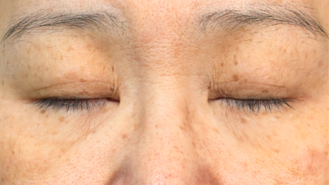 Postoperative Condition Part 1