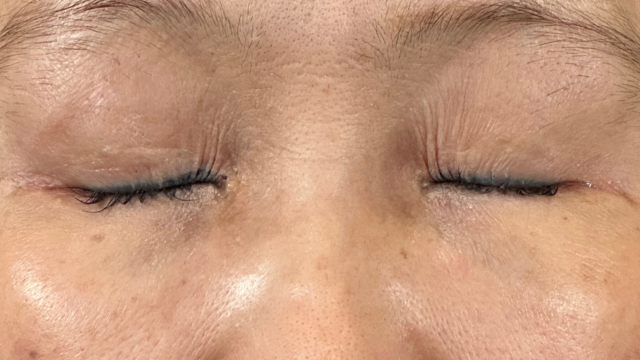 Postoperative Condition Part 1