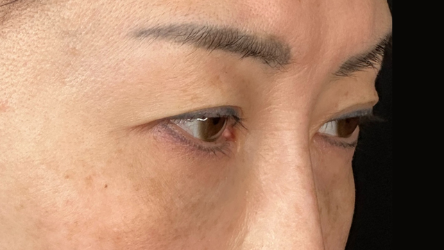 Postoperative Condition Part 1