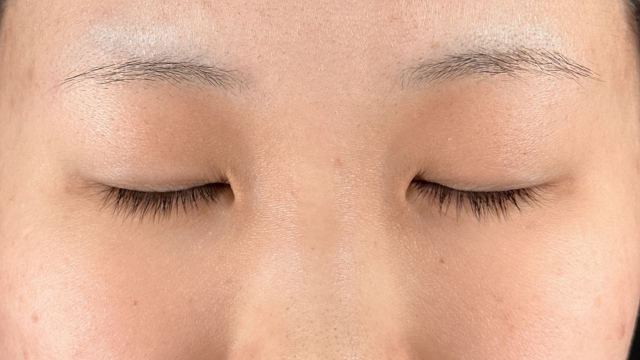 Postoperative Condition Part 1