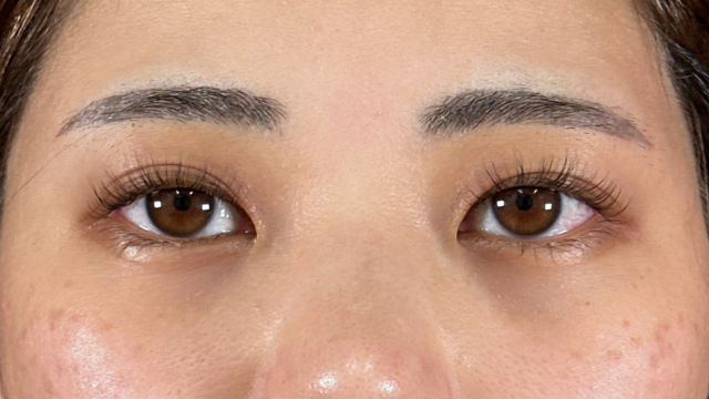 Postoperative Condition Part 1