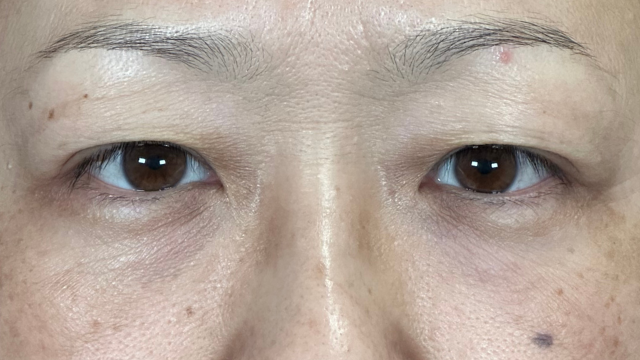 Postoperative Condition Part 1