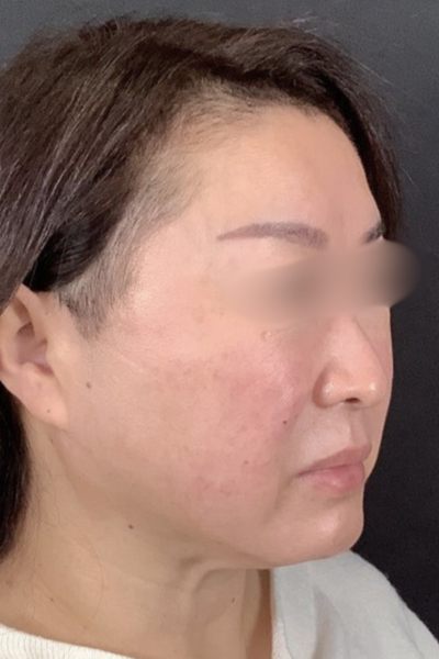 Postoperative Condition Part 1