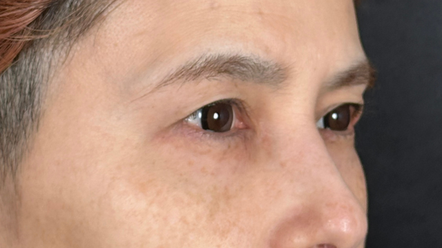 Postoperative Condition Part 1