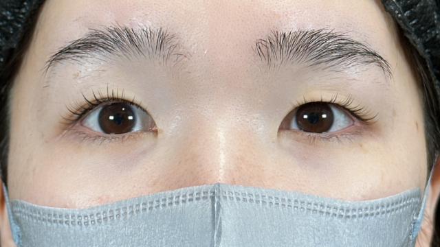 Postoperative Condition Part 1