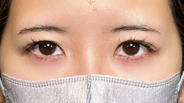 Postoperative Condition Part 1