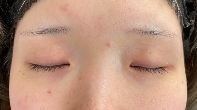 Postoperative Condition Part 1