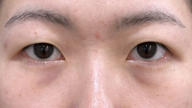 Postoperative Condition Part 1