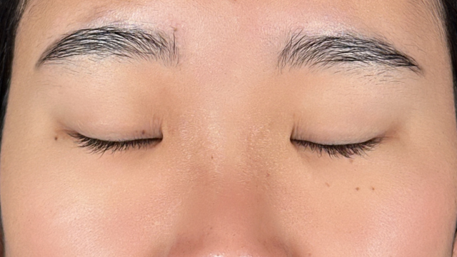 Postoperative Condition Part 1