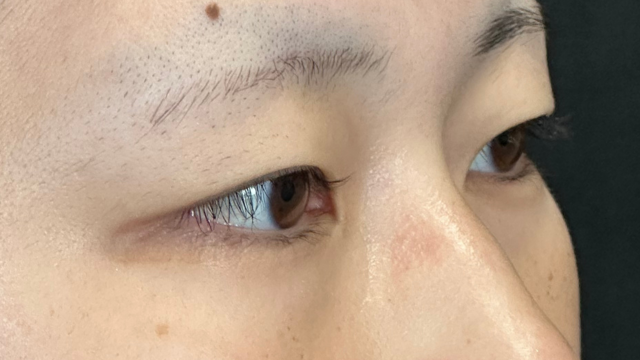 Postoperative Condition Part 1