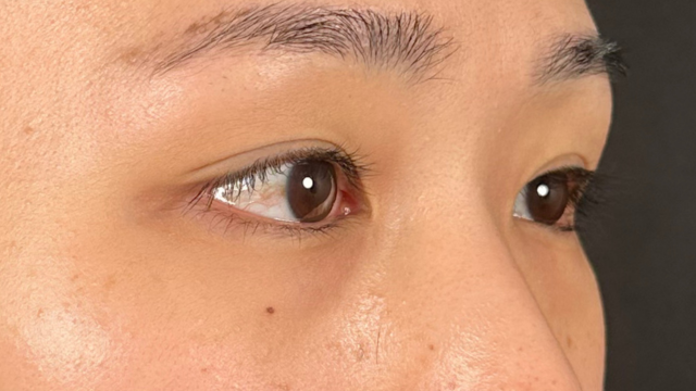 Postoperative Condition Part 1