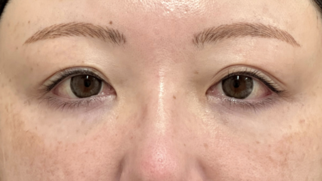 Postoperative Condition Part 1