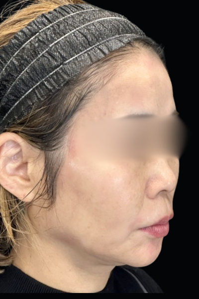 Postoperative Condition Part 1