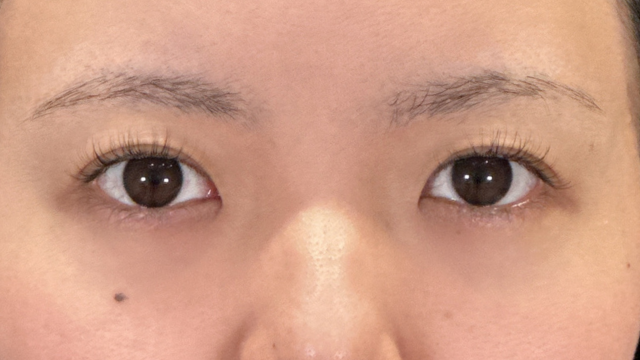 Postoperative Condition Part 1