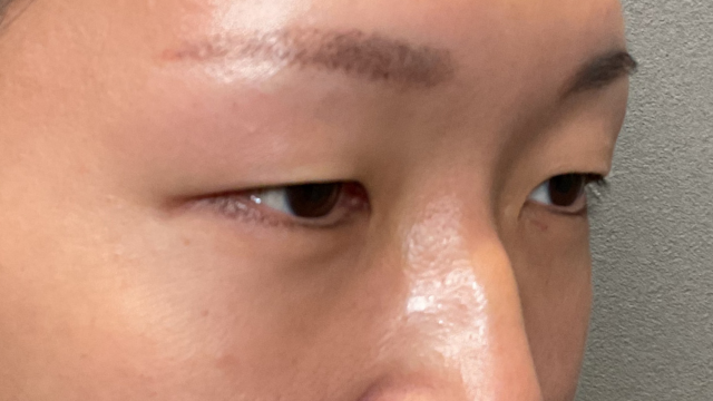 Postoperative Condition Part 1