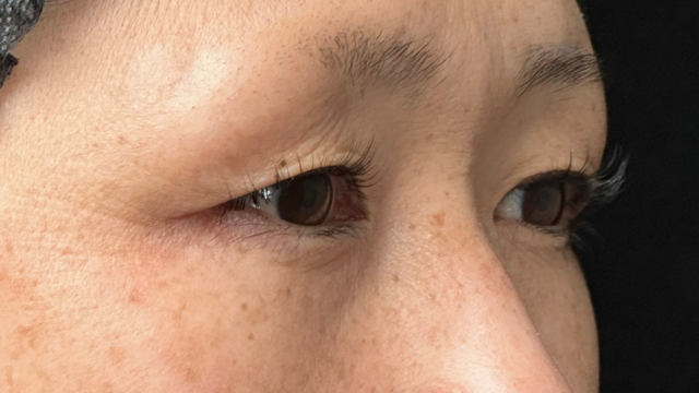 Postoperative Condition Part 1