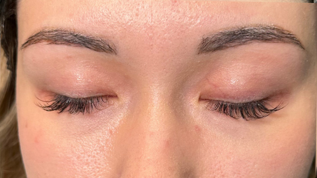 Postoperative Condition Part 1