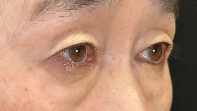 Postoperative Condition Part 1