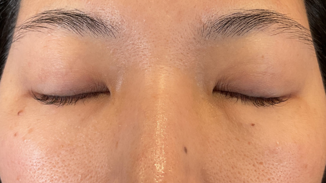 Postoperative Condition Part 1