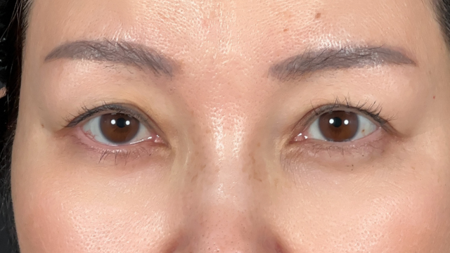 Postoperative Condition Part 1