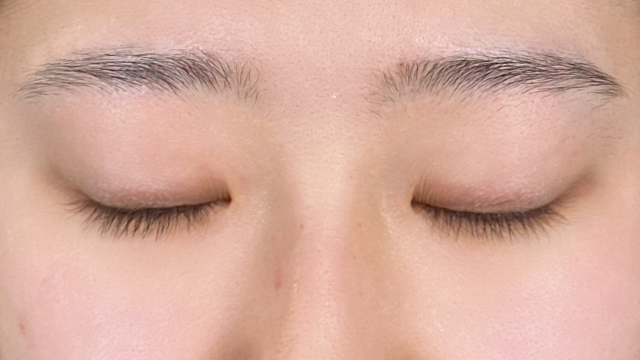 Postoperative Condition Part 1