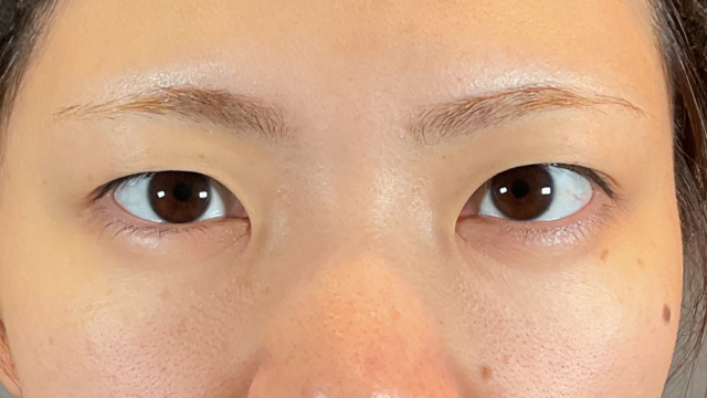 Postoperative Condition Part 1