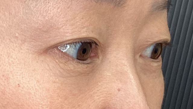 Postoperative Condition Part 1