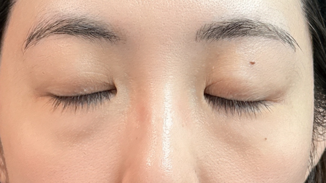 Postoperative Condition Part 1