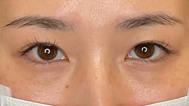 Postoperative Condition Part 1