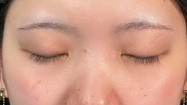 Postoperative Condition Part 1