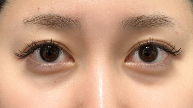 Postoperative Condition Part 1