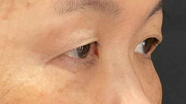 Postoperative Condition Part 1