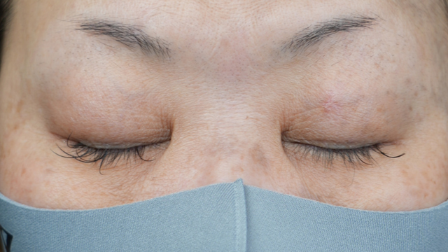 Postoperative Condition Part 1