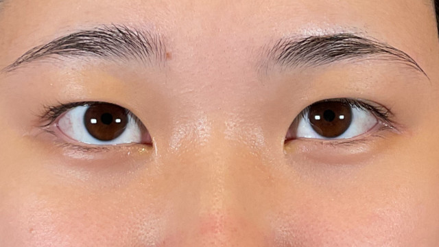 Postoperative Condition Part 1