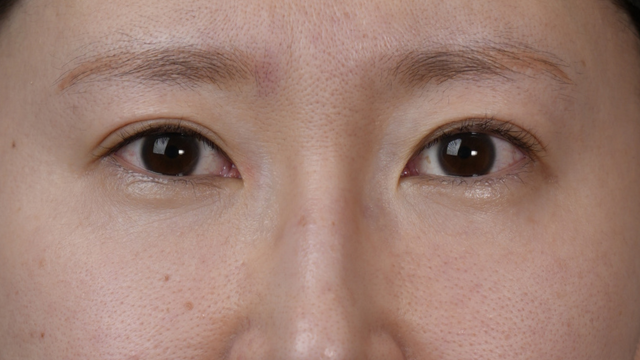 Postoperative Condition Part 1