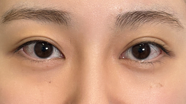 Postoperative Condition Part 1