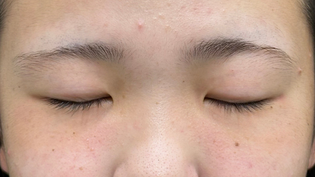 Postoperative Condition Part 1