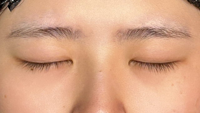 Postoperative Condition Part 1