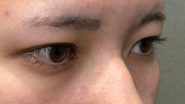 Postoperative Condition Part 1