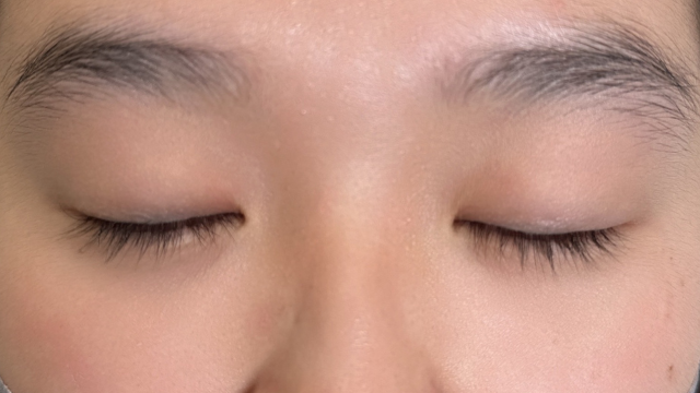 Postoperative Condition Part 1