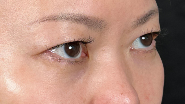 Postoperative Condition Part 1